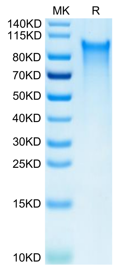 Human CX3CL1 on Tris-Bis PAGE under reduced condition. The purity is greater than 95%.Recombinant Human CX3CL1/Fractalkine Protein