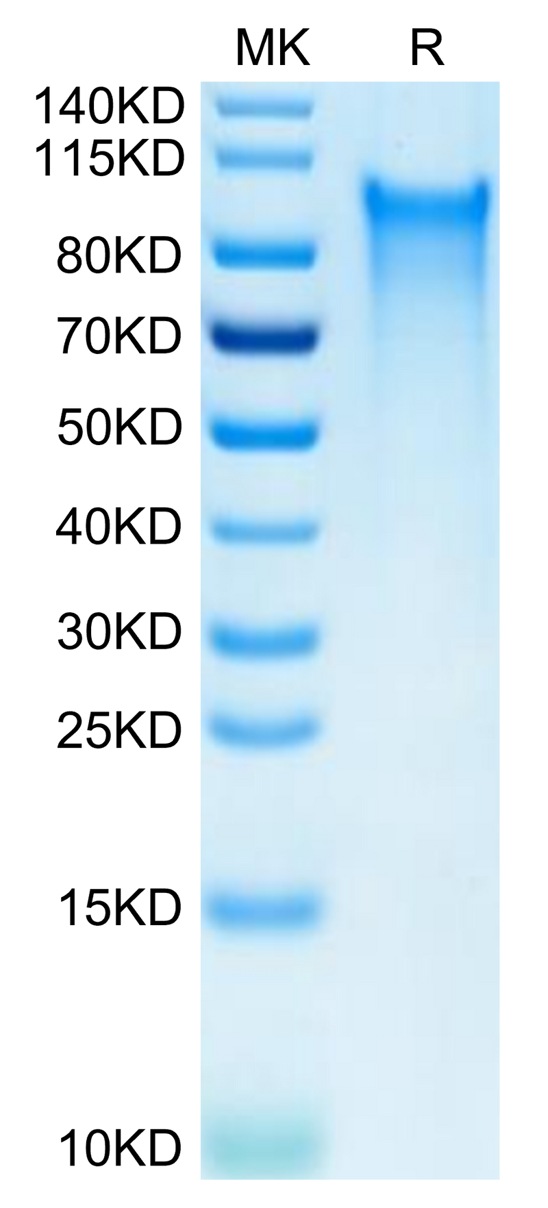 Human CX3CL1 on Tris-Bis PAGE under reduced condition. The purity is greater than 95%.Recombinant Human CX3CL1/Fractalkine Protein