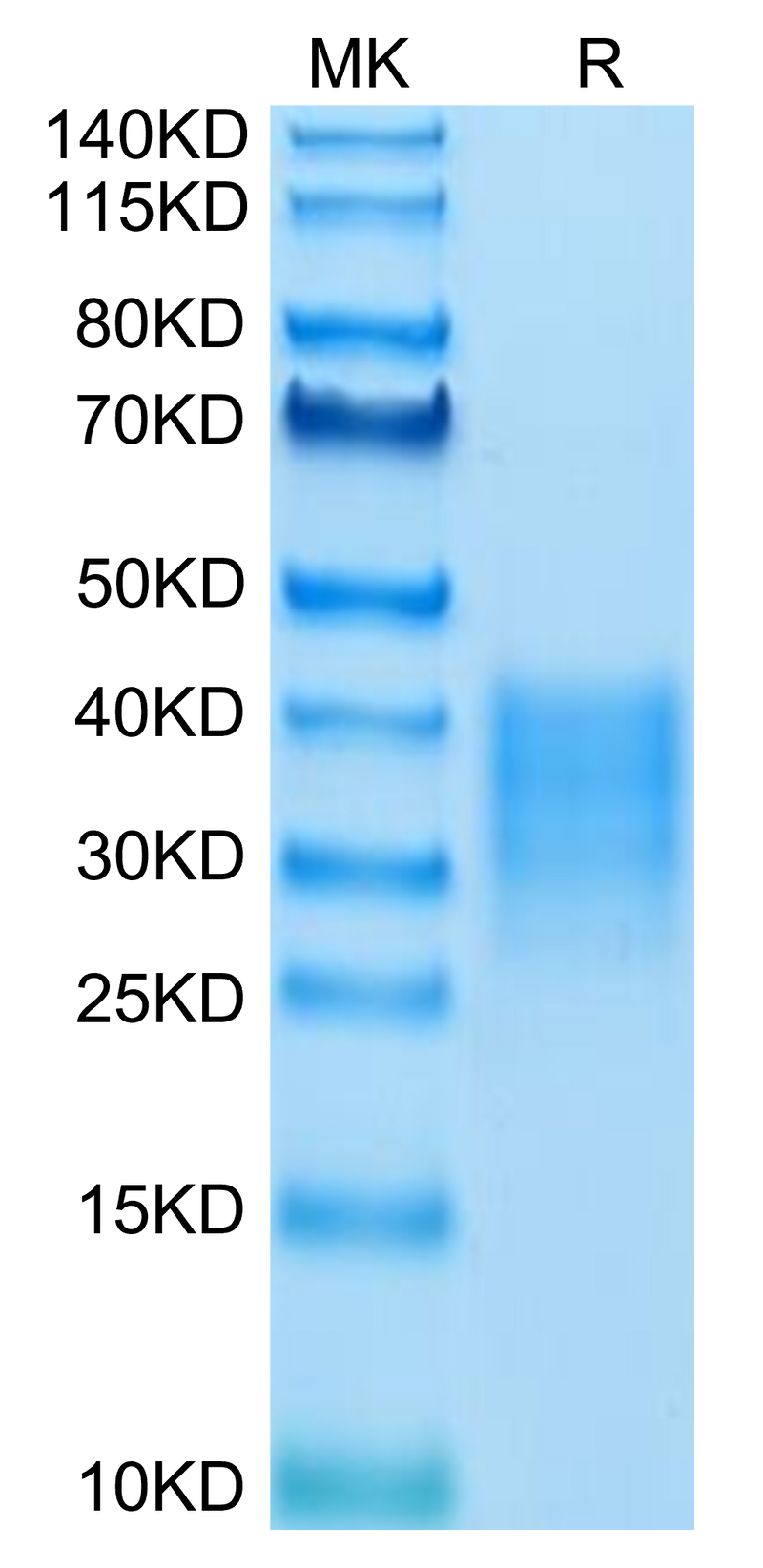 Human Fas on Tris-Bis PAGE under reduced condition. The purity is greater than 95%.Recombinant Human Fas/TNFRSF6/CD95 Protein, Active