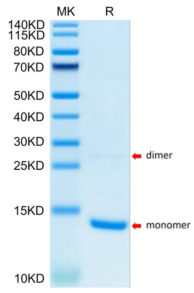 Human S100A9/MRP14 on Tris-Bis PAGE under reduced condition. The purity is greater than 95%.Recombinant Human S100A9/MRP14 Protein