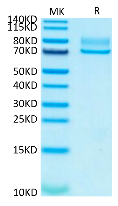 Human Syndecan-1 on Tris-Bis PAGE under reduced condition. The purity is greater than 95%.Recombinant Human Syndecan-1 Protein, Active