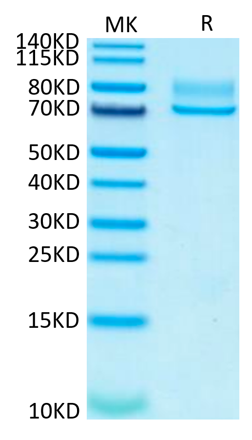 Human Syndecan-1 on Tris-Bis PAGE under reduced condition. The purity is greater than 95%.Recombinant Human Syndecan-1 Protein, Active
