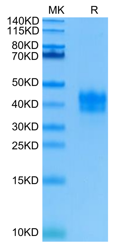 Human TNFR1 on Tris-Bis PAGE under reduced condition. The purity is greater than 95%.Recombinant Human TNFR1/CD120a/TNFRSF1A Protein, Active