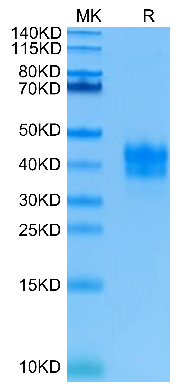 Human TNFR1 on Tris-Bis PAGE under reduced condition. The purity is greater than 95%.Recombinant Human TNFR1/CD120a/TNFRSF1A Protein, Active