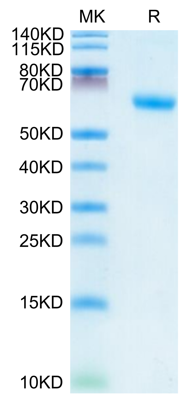 Human TNFR1 on Tris-Bis PAGE under reduced condition. The purity is greater than 95%.Recombinant Human TNFR1/CD120a/TNFRSF1A Protein, Active
