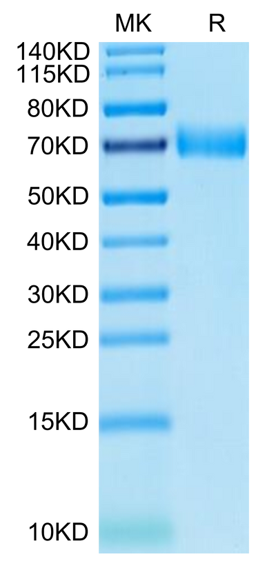Human SLAMF7 on Tris-Bis PAGE under reduced condition. The purity is greater than 95%.Recombinant Human SLAMF7/CRACC/CD319 Protein, Active