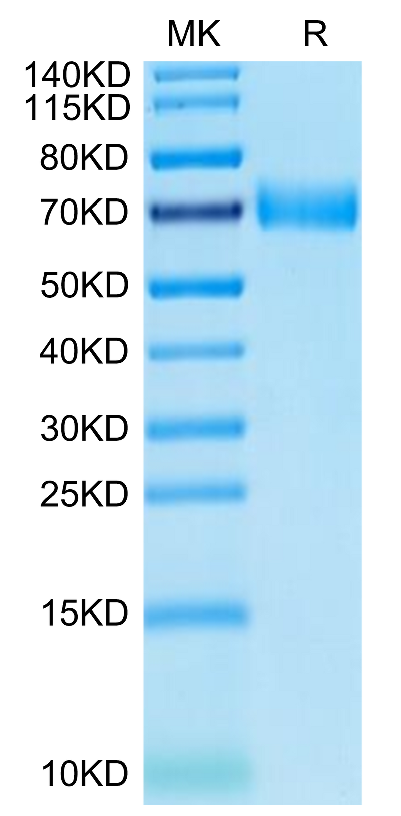 Human SLAMF7 on Tris-Bis PAGE under reduced condition. The purity is greater than 95%.Recombinant Human SLAMF7/CRACC/CD319 Protein, Active