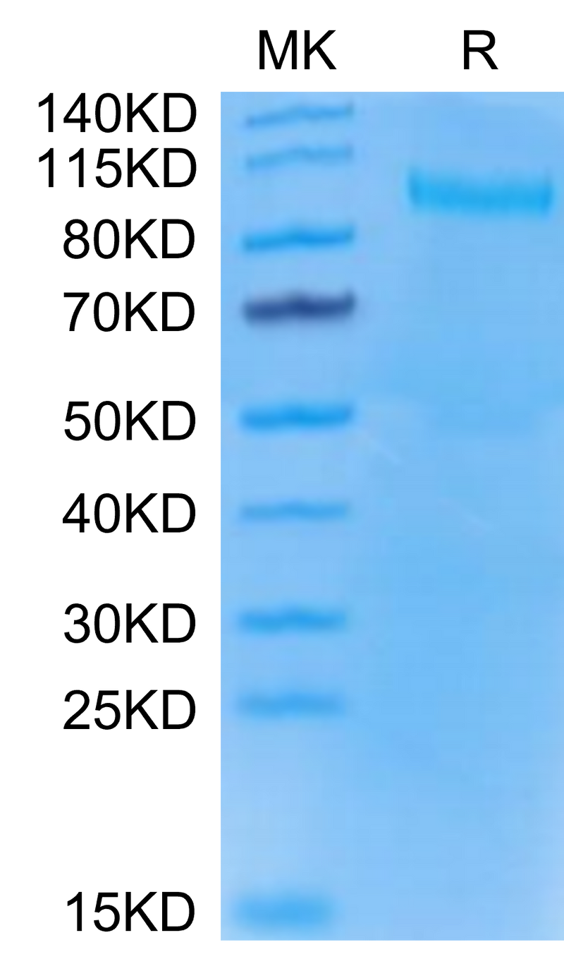 Mouse TLR3 on Tris-Bis PAGE under reduced condition. The purity is greater than 95%.Recombinant Mouse TLR3 Protein