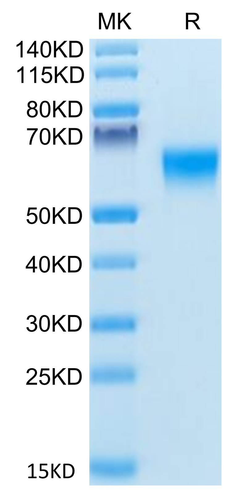 Human BACE-1 on Tris-Bis PAGE under reduced condition. The purity is greater than 95%.Recombinant Human BACE-1 Protein