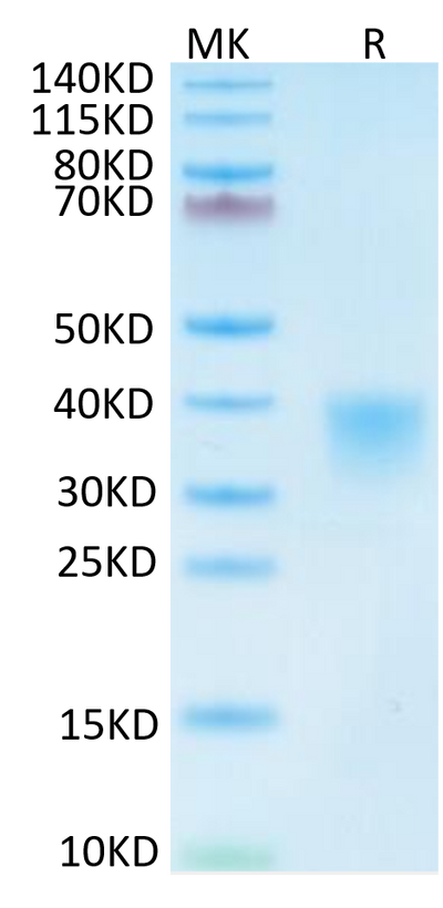 Mouse CD8 alpha on Tris-Bis PAGE under reduced condition. The purity is greater than 95%.Recombinant Mouse CD8 alpha/CD8A Protein