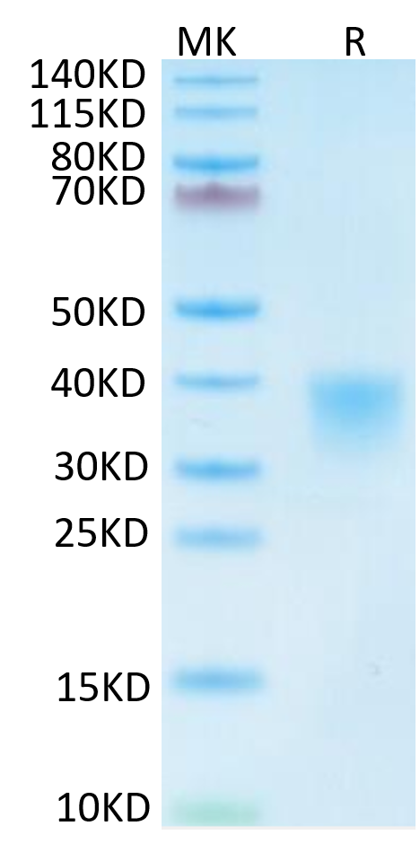 Mouse CD8 alpha on Tris-Bis PAGE under reduced condition. The purity is greater than 95%.Recombinant Mouse CD8 alpha/CD8A Protein