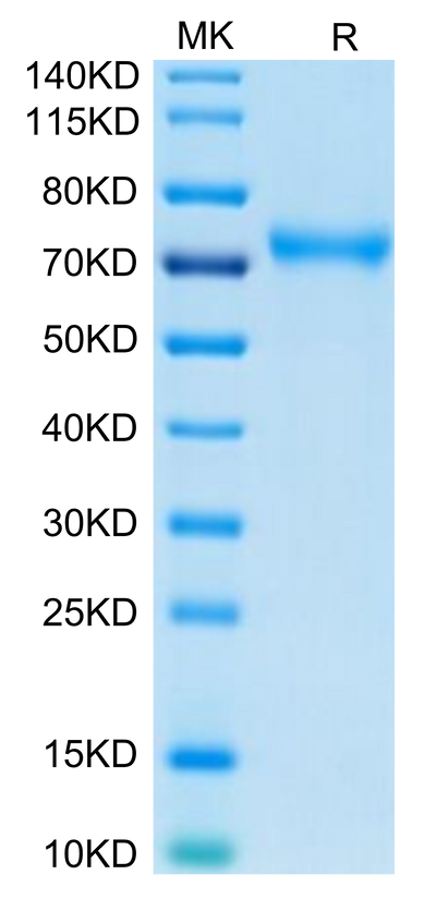 Human CD229 on Tris-Bis PAGE under reduced condition. The purity is greater than 95%.Recombinant Human CD229/SLAMF3 Protein