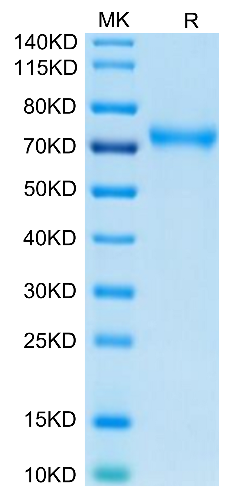 Human CD229 on Tris-Bis PAGE under reduced condition. The purity is greater than 95%.Recombinant Human CD229/SLAMF3 Protein