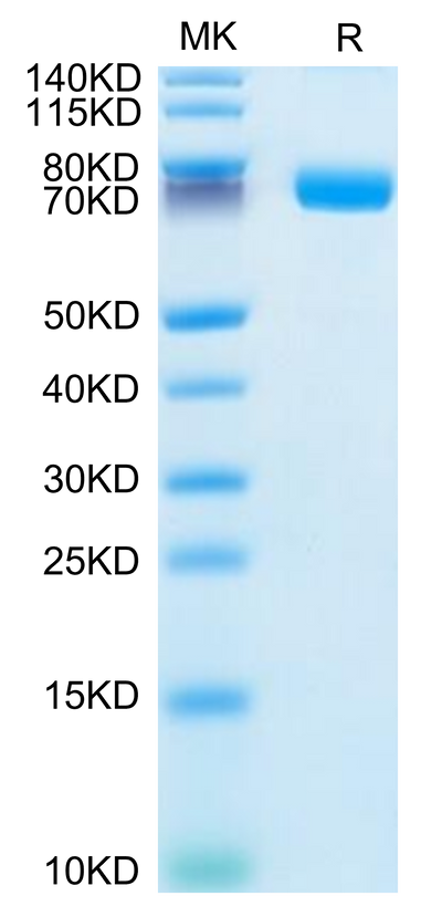 Human IL-1R2 on Tris-Bis PAGE under reduced condition. The purity is greater than 95%.Recombinant Human IL-1R2/IL-1 RII/CD121b Protein, Active