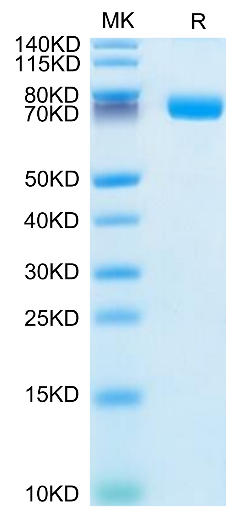 Human IL-1R2 on Tris-Bis PAGE under reduced condition. The purity is greater than 95%.Recombinant Human IL-1R2/IL-1 RII/CD121b Protein, Active
