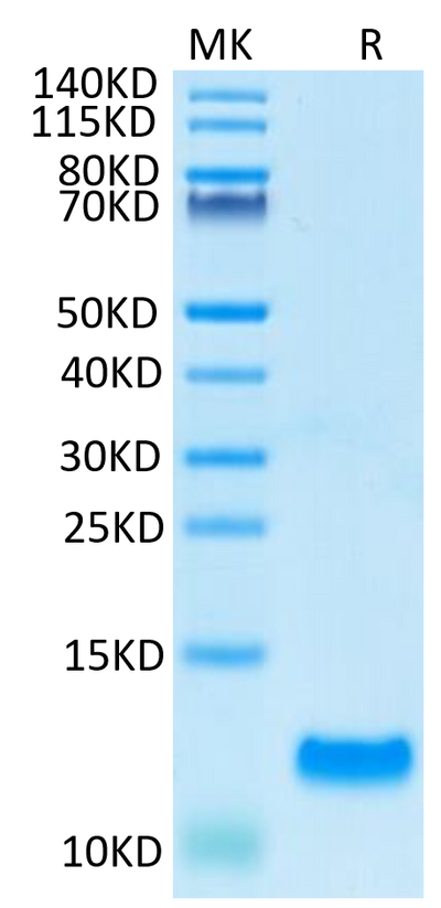 Human CCL20 on Tris-Bis PAGE under reduced condition. The purity is greater than 95%.Recombinant Human CCL20 Protein