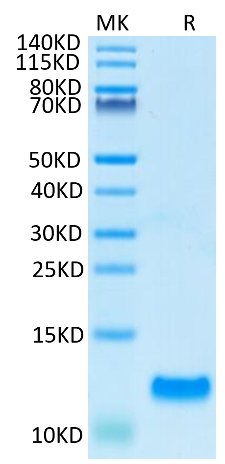 Human CCL20 on Tris-Bis PAGE under reduced condition. The purity is greater than 95%.Recombinant Human CCL20 Protein