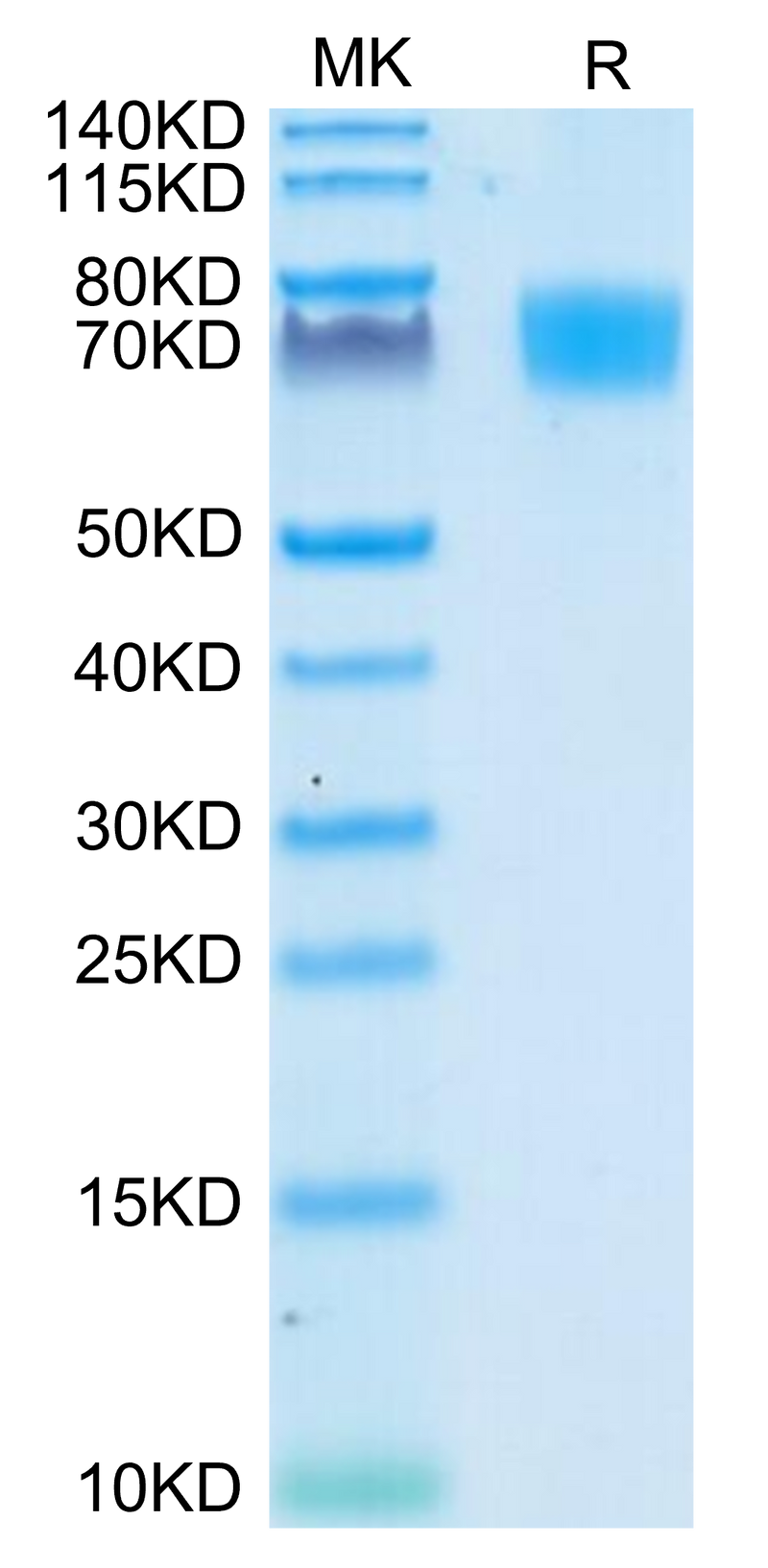 Human ALCAM on Tris-Bis PAGE under reduced condition. The purity is greater than 95%.