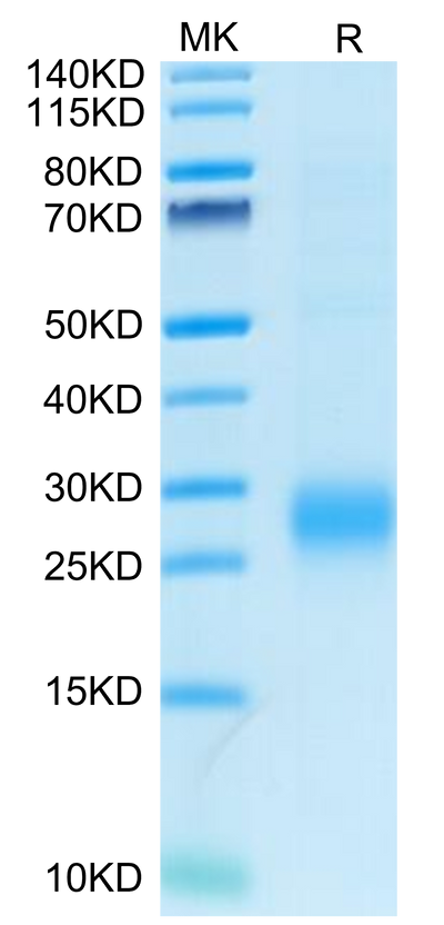Human ALK-1/ACVRL1 on Tris-Bis PAGE under reduced condition. The purity is greater than 95%.Recombinant Human ALK-1/ACVRL1 Protein