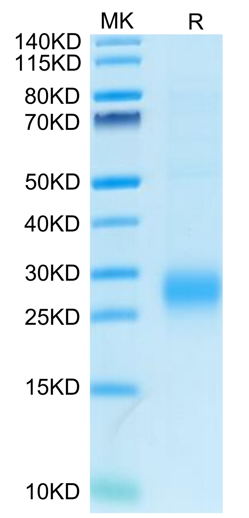 Human ALK-1/ACVRL1 on Tris-Bis PAGE under reduced condition. The purity is greater than 95%.Recombinant Human ALK-1/ACVRL1 Protein
