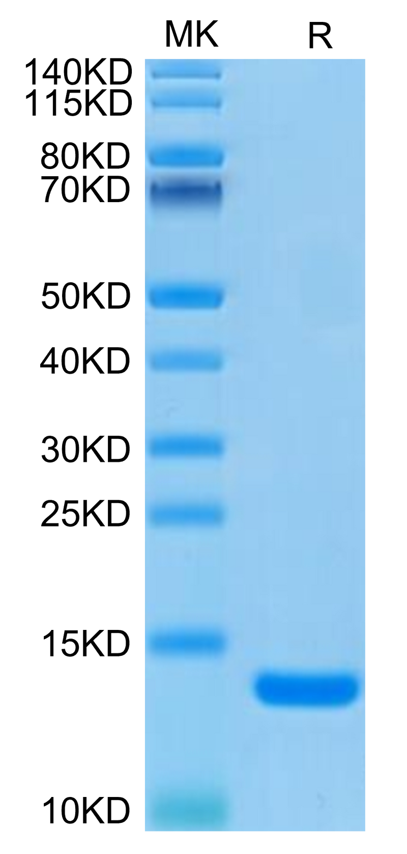 Human B2M on Tris-Bis PAGE under reduced condition. The purity is greater than 95%.Recombinant Human B2M/beta 2-Microglobulin Protein