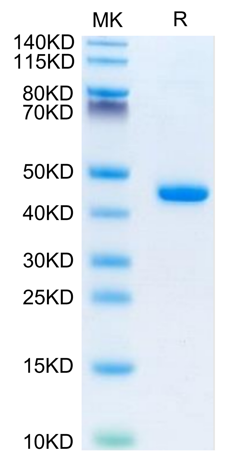 Mouse B2M on Tris-Bis PAGE under reduced condition. The purity is greater than 95%.Recombinant Mouse B2M/beta 2-Microglobulin Protein