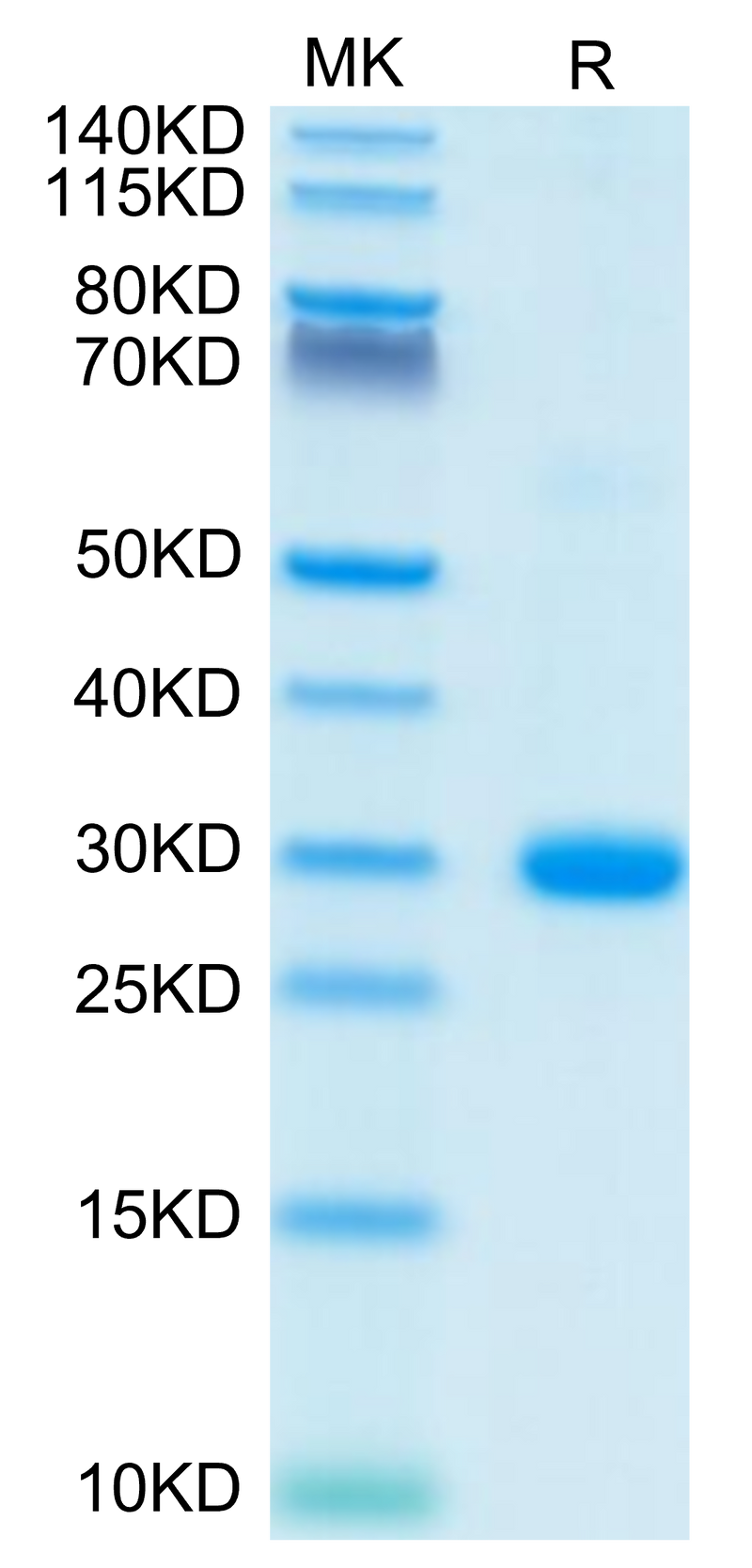 Human BTN3A2 on Tris-Bis PAGE under reduced condition. The purity is greater than 95%.Recombinant Human BTN3A2 Protein