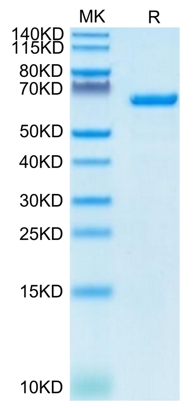 Human Serum Albumin on Tris-Bis PAGE under reduced condition. The purity is greater than 95%.Recombinant Human Serum Albumin Protein, Active