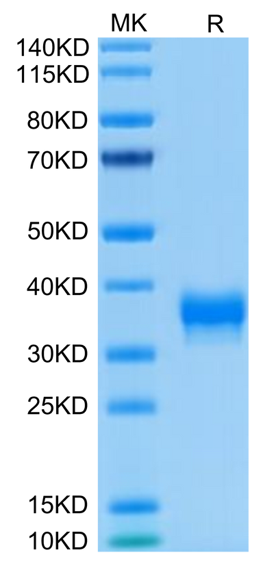 Human BTN1A1 on Tris-Bis PAGE under reduced condition. The purity is greater than 95%.Recombinant Human BTN1A1/Butyrophilin Protein