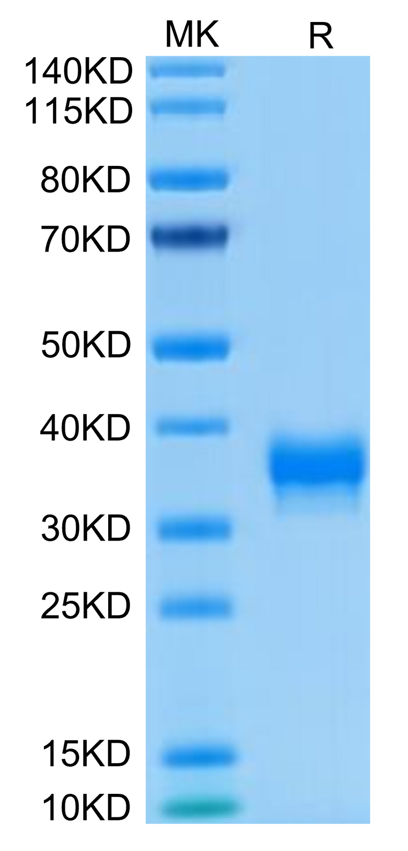 Human BTN1A1 on Tris-Bis PAGE under reduced condition. The purity is greater than 95%.Recombinant Human BTN1A1/Butyrophilin Protein
