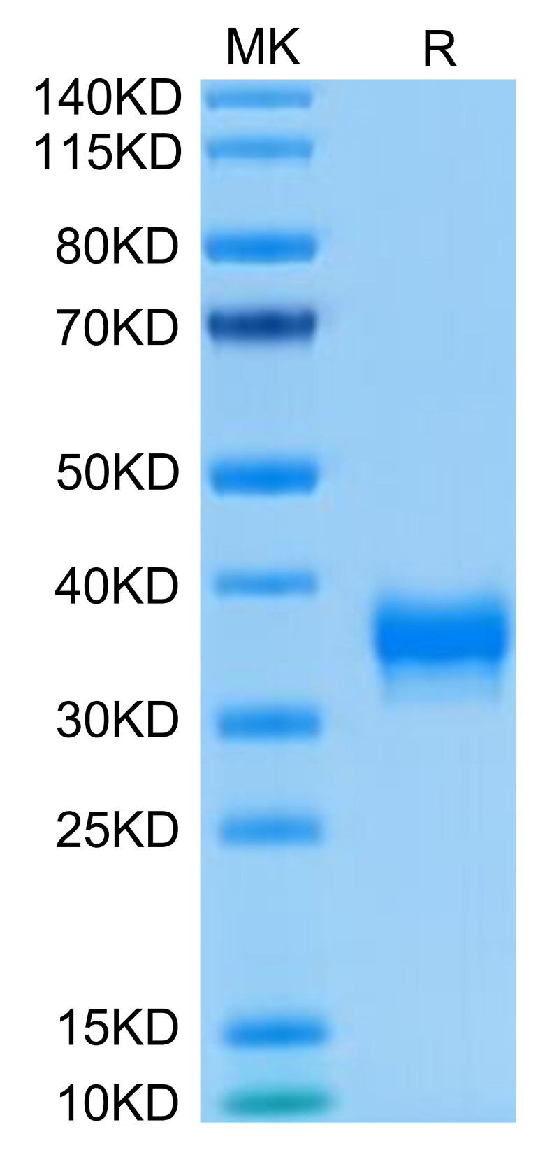 Biotinylated Human BTN1A1 on Tris-Bis PAGE under reduced condition. The purity is greater than 95%.Biotinylated Human BTN1A1/Butyrophilin Protein