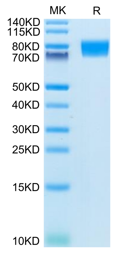 Human CD117 on Tris-Bis PAGE under reduced condition. The purity is greater than 95%.Recombinant Human CD117 Protein, Active