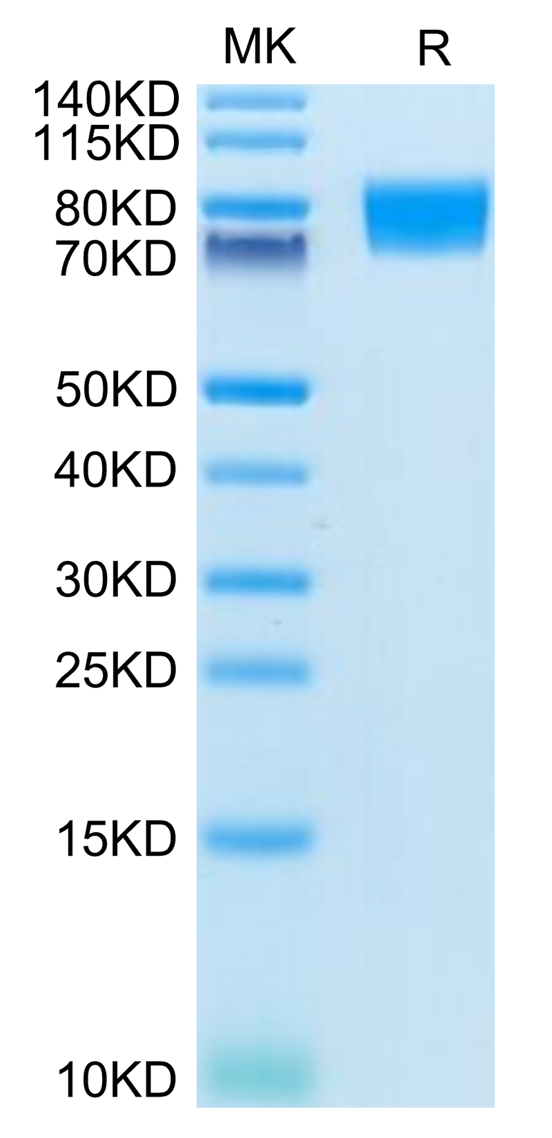 Human CD117 on Tris-Bis PAGE under reduced condition. The purity is greater than 95%.Recombinant Human CD117 Protein, Active