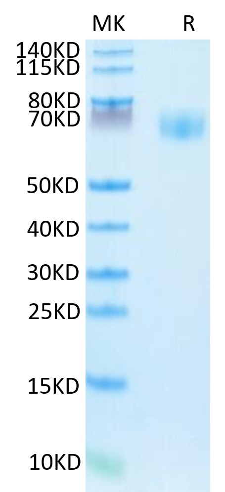 Human IFNGR1 on Tris-Bis PAGE under reduced condition. The purity is greater than 95%.Recombinant Human IFN gamma R1/IFNGR1 Protein, Active