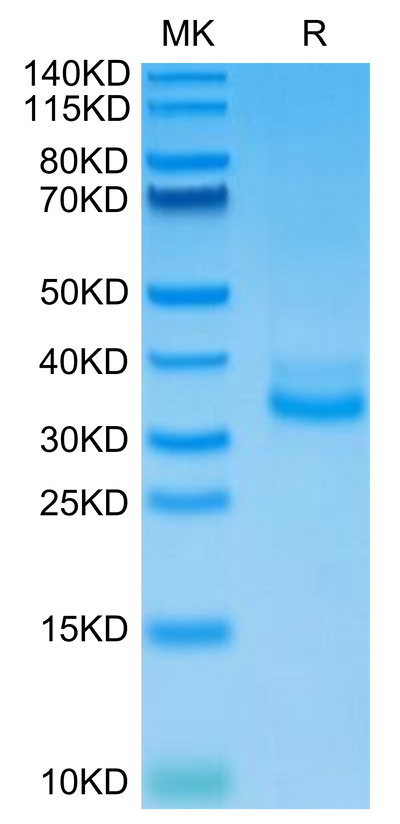 Mouse CLEC12A on Tris-Bis PAGE under reduced condition. The purity is greater than 95%.Recombinant Mouse CLEC12A/MICL/CLL-1 Protein