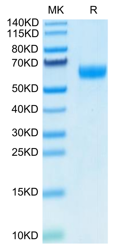 Human Ephrin B2 on Tris-Bis PAGE under reduced condition. The purity is greater than 95%.Recombinant Human Ephrin-B2/EFNB2 Protein, Active