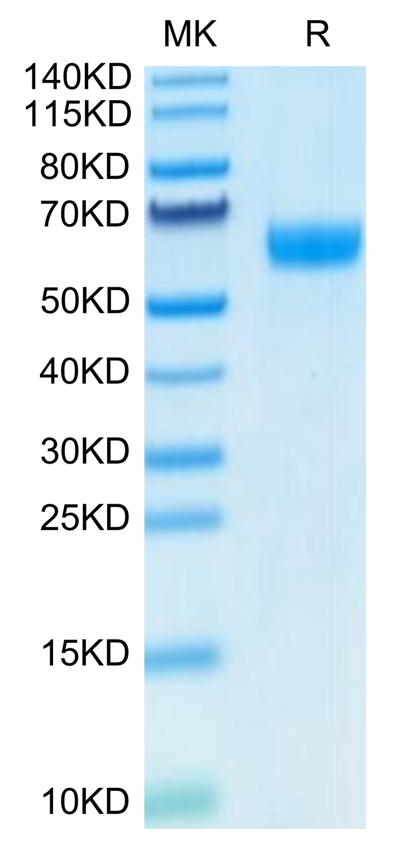 Human Ephrin B2 on Tris-Bis PAGE under reduced condition. The purity is greater than 95%.Recombinant Human Ephrin-B2/EFNB2 Protein, Active