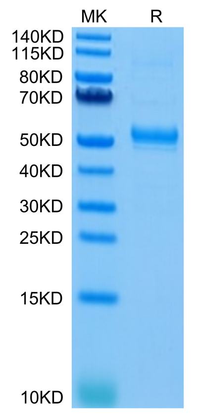 Human CD37 on Tris-Bis PAGE under reduced condition. The purity is greater than 95%.Recombinant Human CD37 Protein