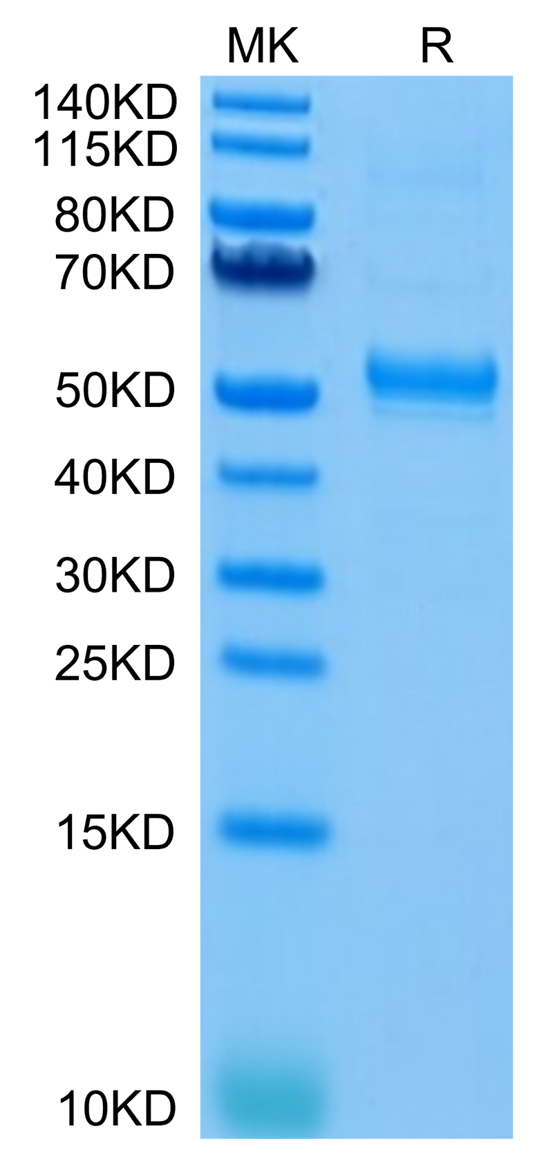 Human CD37 on Tris-Bis PAGE under reduced condition. The purity is greater than 95%.Recombinant Human CD37 Protein