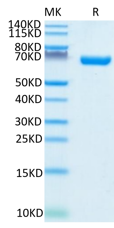 Human CD38 on Tris-Bis PAGE under reduced condition. The purity is greater than 95%.Recombinant Human CD38 Protein, Active