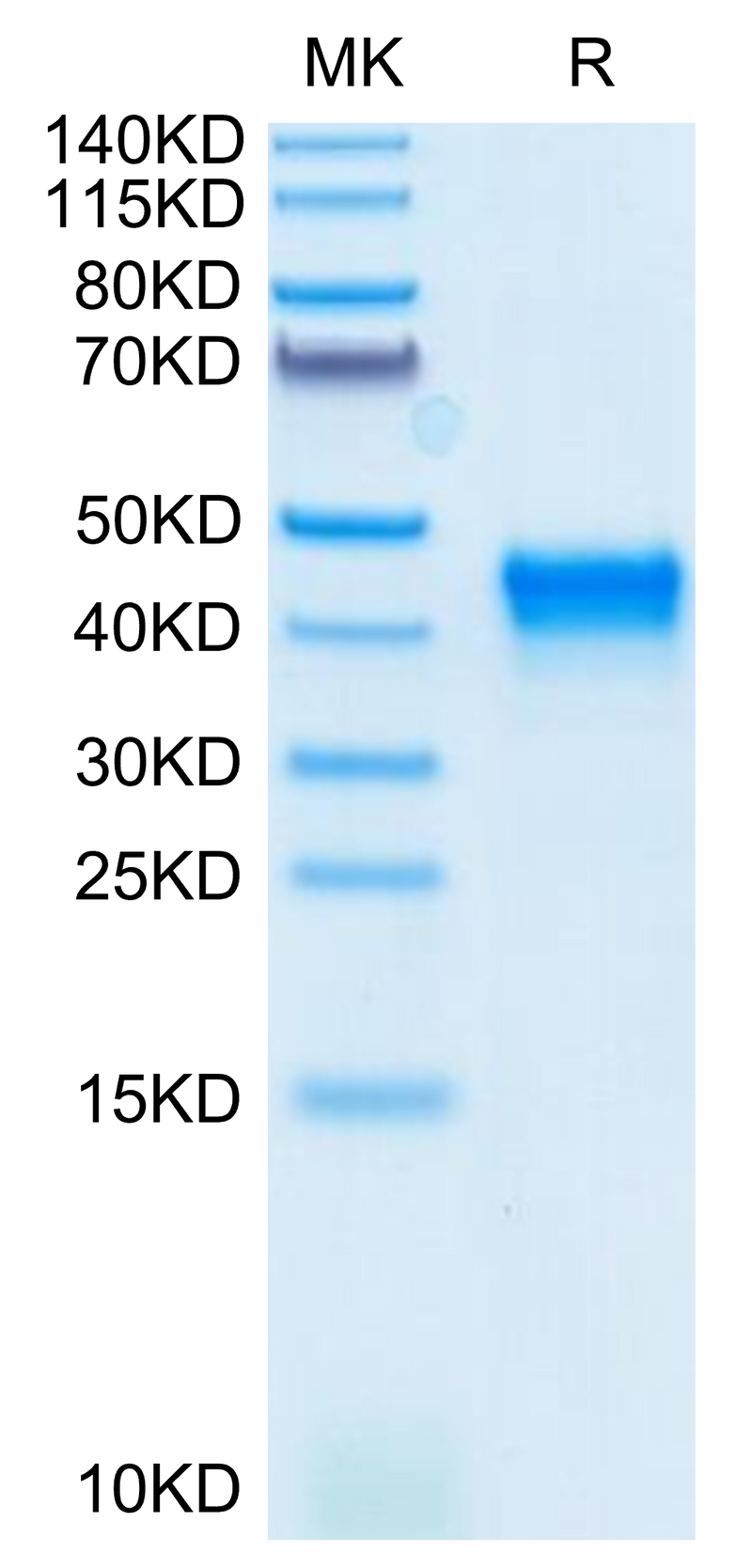 Mouse CD38 on Tris-Bis PAGE under reduced condition. The purity is greater than 95%.