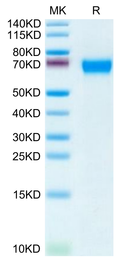 Human CD46 on Tris-Bis PAGE under reduced condition. The purity is greater than 95%.Recombinant Human CD46 Protein, Active