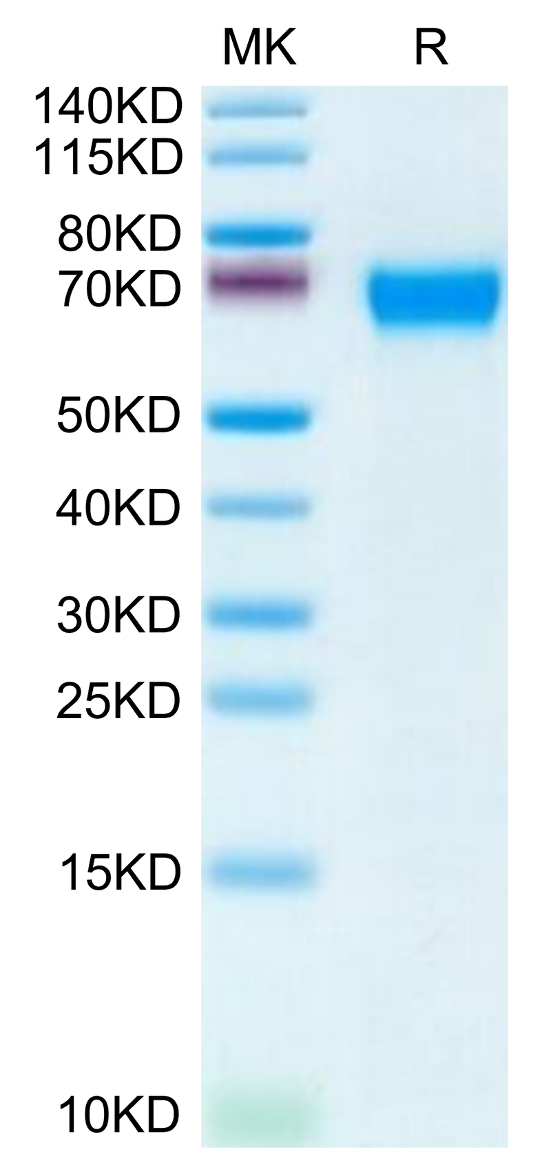 Human CD46 on Tris-Bis PAGE under reduced condition. The purity is greater than 95%.Recombinant Human CD46 Protein, Active