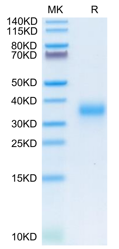 Human CD74 on Tris-Bis PAGE under reduced condition. The purity is greater than 95%.Recombinant Human CD74/DHLAG Protein, Active