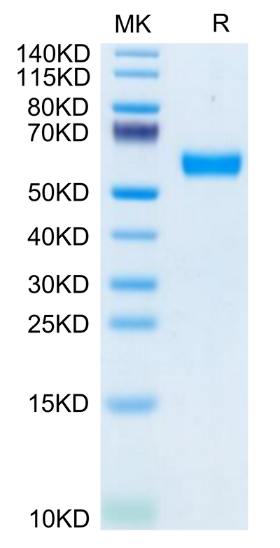 Mouse CD83 on Tris-Bis PAGE under reduced condition. The purity is greater than 95%.Recombinant Mouse CD83 Protein