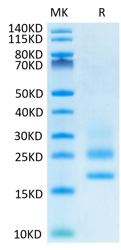 Human CD83 on Tris-Bis PAGE under reduced condition. The purity is greater than 95%.Recombinant Human CD83 Protein, Active