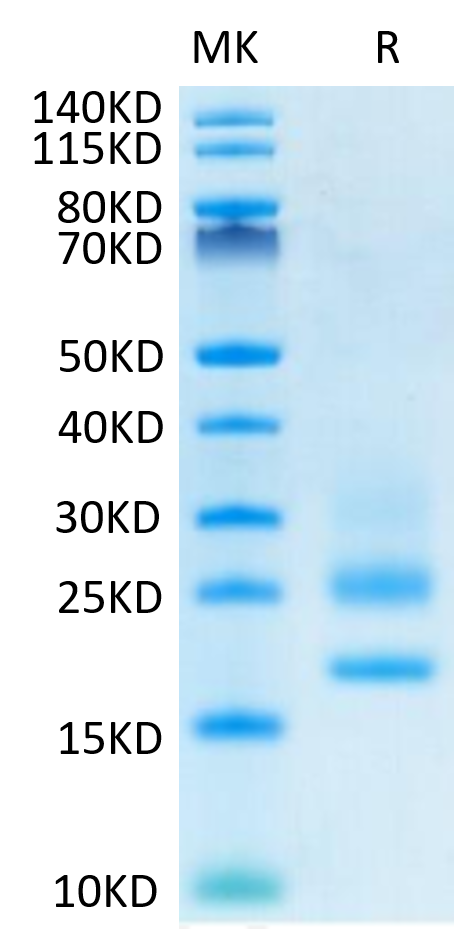 Human CD83 on Tris-Bis PAGE under reduced condition. The purity is greater than 95%.Recombinant Human CD83 Protein, Active