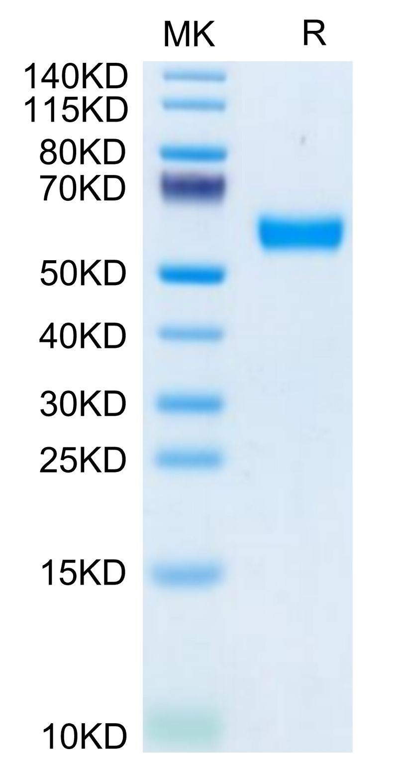 Mouse CD83 on Tris-Bis PAGE under reduced condition. The purity is greater than 95%.Recombinant Mouse CD83 Protein