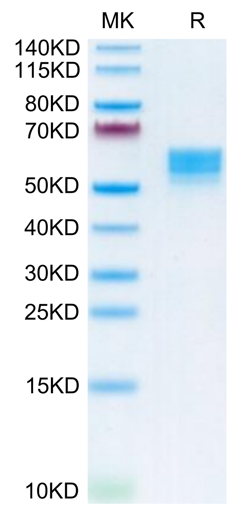 Human CD83 on Tris-Bis PAGE under reduced condition. The purity is greater than 95%.Recombinant Human CD83 Protein, Active
