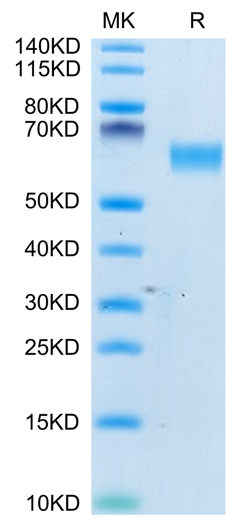 Human CD98 on Tris-Bis PAGE under reduced condition. The purity is greater than 95%.Recombinant Human CD98 Protein, Active